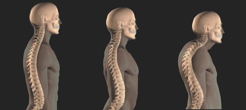 Как ведет себя вдовий горб со временем