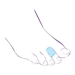 СТ-45 (L) Приспособление корригирующие (кольцо защитное)