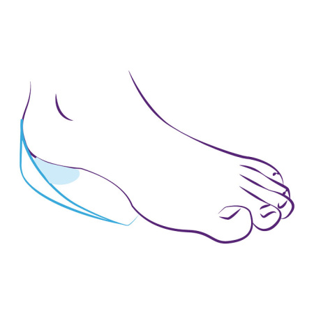 Подпяточники ортопедические силиконовые с бортиками СТ-41  Trives