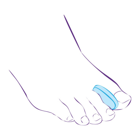 Межпальцевый вкладыш СТ-32  Trives